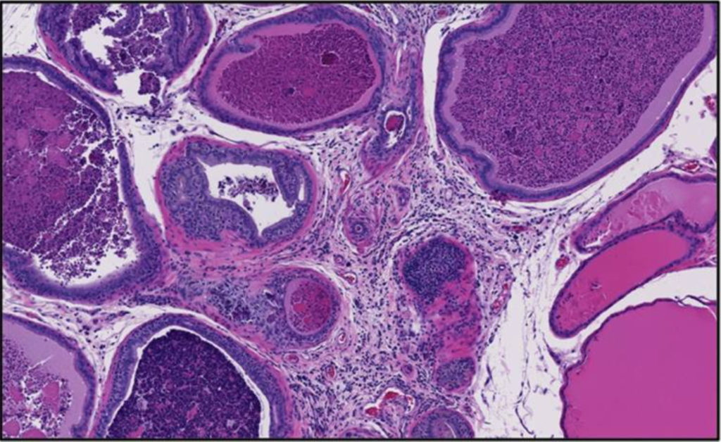 Section of dorsal lobe from NTP study not supporting fluoride as a neurotoxin